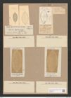 Navicula brasiliensis Grun. (de-Toni-Nr.: Genus 1, Species 135) Zeichnungen Sammlung Grunow Nr. 413 (NHMW-BOT-W0366724)
